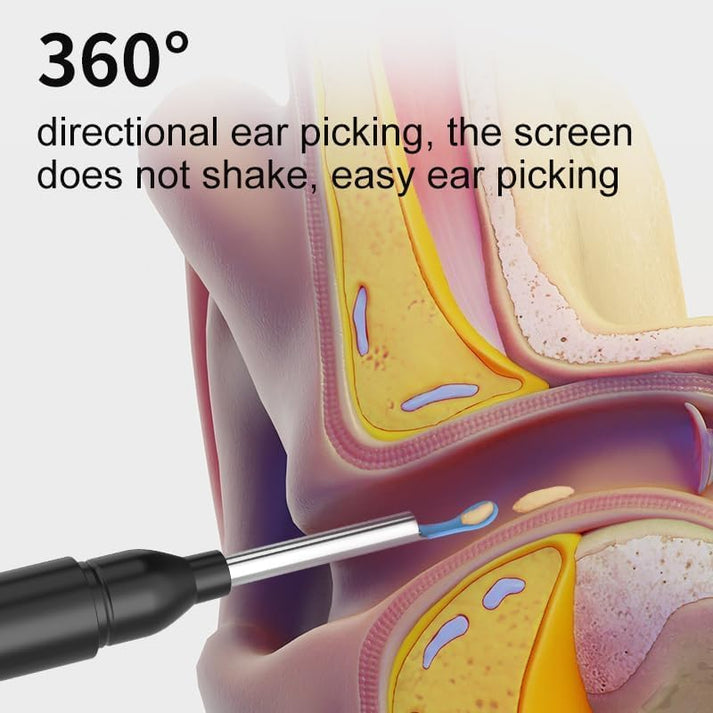 Smart Visual Ear Wax Cleaner